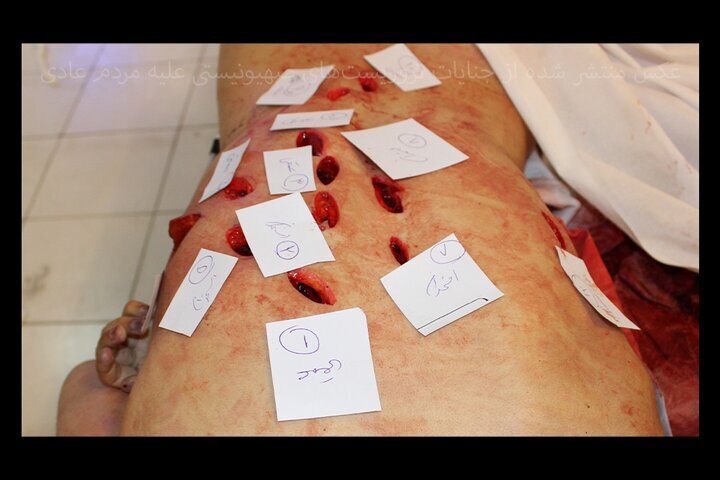 (۱۶+) تصاویری از حمله به ارگان‌های حیاتی بدن در آشوب های اخیر | دیدن این تصاویر برای همه جایز نیست