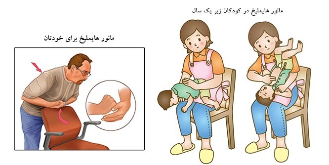 اگر تنها بودید، چطور خودتان را از خفگی نجات دهید؟ + آموزش تصویری مانور هایملیخ
