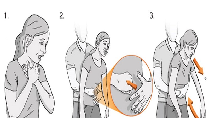 اگر تنها بودید، چطور خودتان را از خفگی نجات دهید؟ + آموزش تصویری مانور هایملیخ