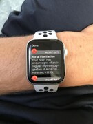 ساعت‌های هوشمند، مشکلات پنهان قلب را تشخیص می‌دهند