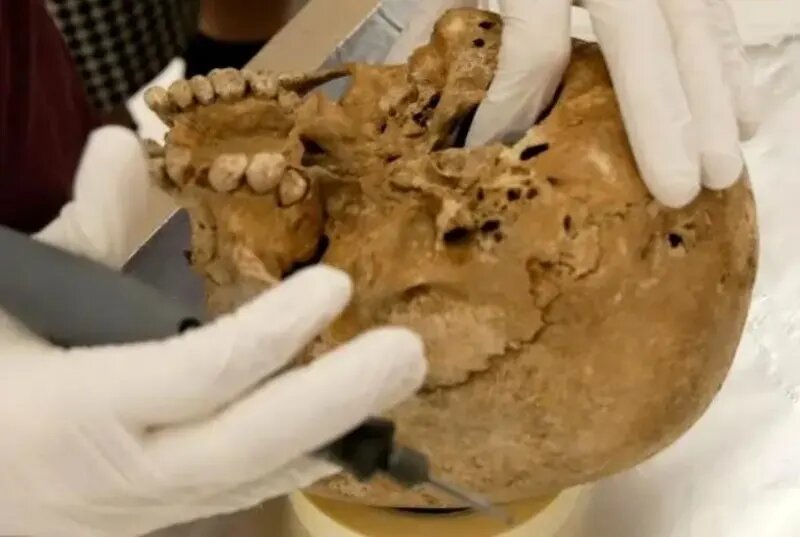 این اسکلت ۱۲ هزار ساله یک بیماری ژنتیکی نادر دارد! | عکس