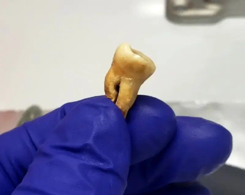 کشف گورستان باستانی در دوران همه‌گیری طاعون! | عکس