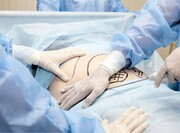 انواع روش پیکرتراشی و آشنایی تخصصی با هر کدام از روش‌ها