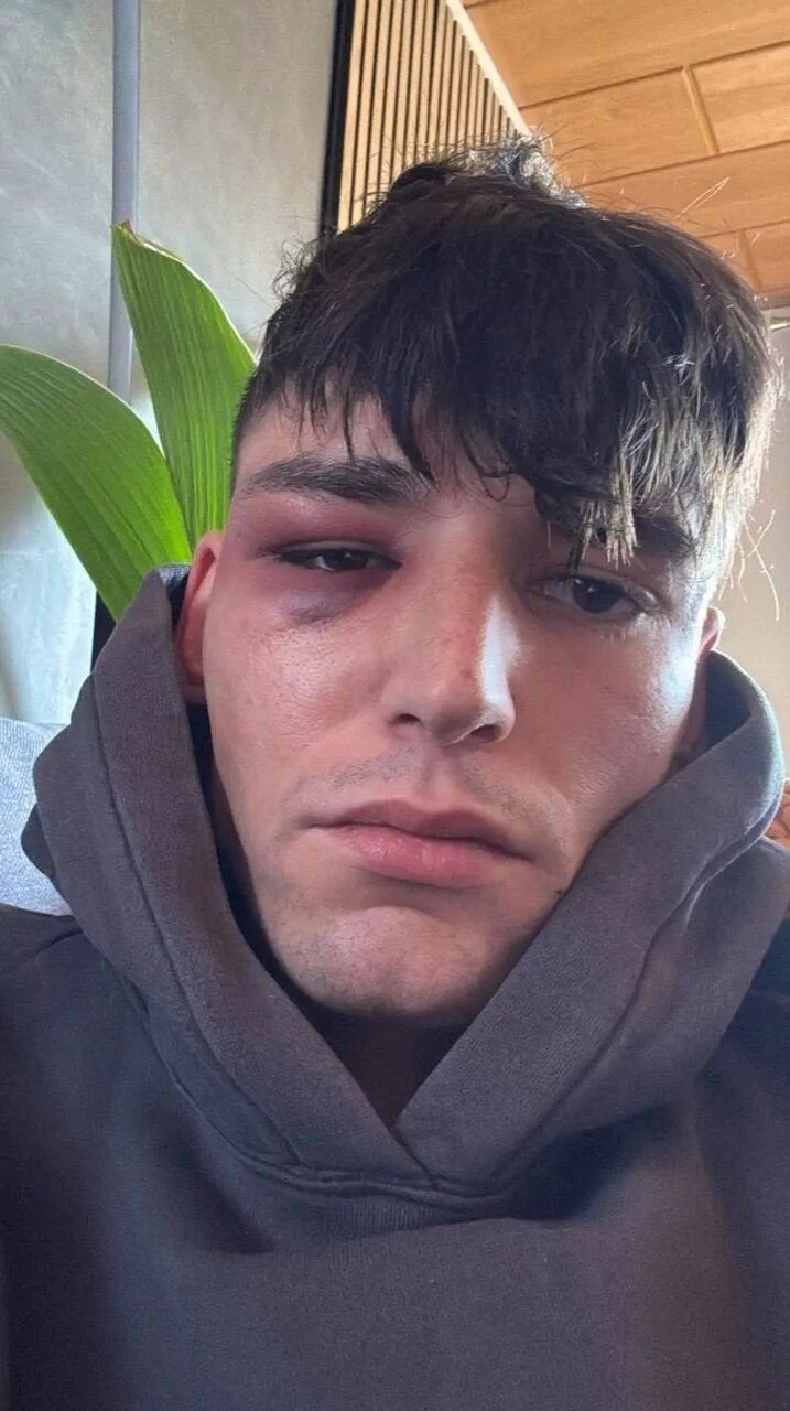 حمله وحشیانه به داوری که در استادیوم خواستگاری کرد! +عکس