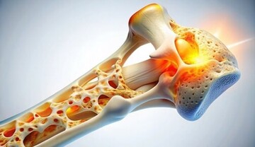 کدام خوراکی‌ها برای سلامت استخوان‌ها خطرناکند؟