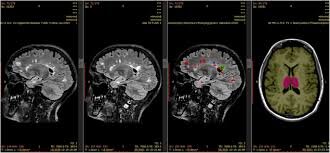 پاسخ نتیجه MRI فقط در چند ثانیه!