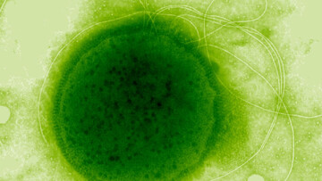 مقاومت زیستی شگفت‌انگیز | میکروبی که می‌تواند دزهای مرگبار تشعشع اتمی را تحمل کند