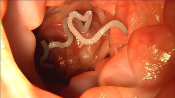 ۱۲ علامت که خبر از وجود انگل‌ها در بدن‌تان می‌دهد! چه کار کنیم؟