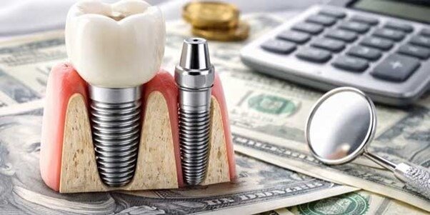 آیا افزایش نرخ دلار روی قیمت کاشت دندان تاثیر دارد؟