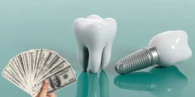 راهکارهای عملی برای مدیریت هزینه کاشت دندان در شرایط ارزی ناپایدار