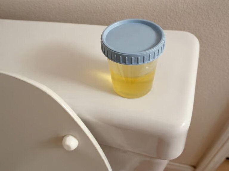 urine