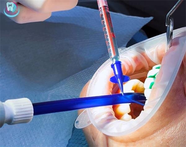 periodental