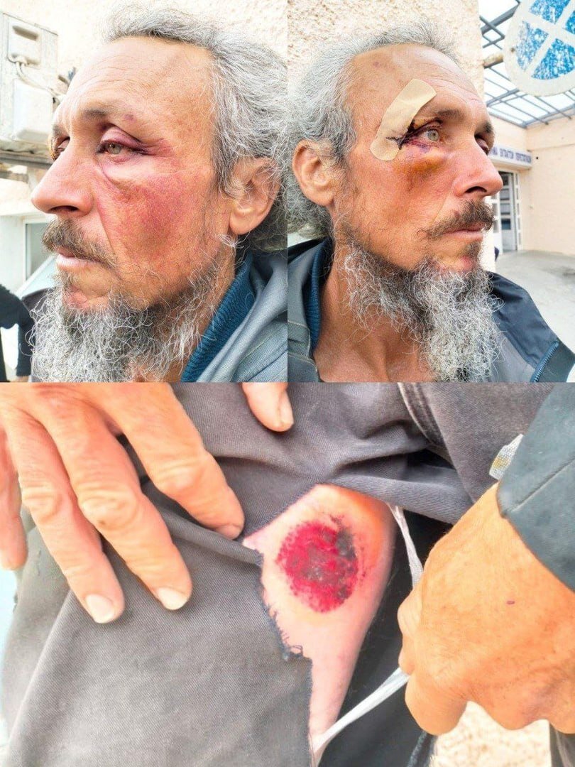 تصاویر هولناک از شکنجه ۴۰ ساعته فعالان کاروان صمود؛ ببینید