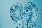 ۳ آسیب جدی کم‌آبی بدن به کلیه‌ها