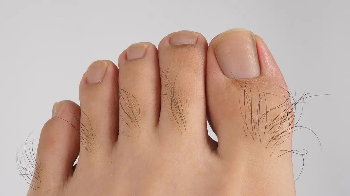 راز سلامت بدن در میزان موهای انگشت پا! | آیا کم شدن موهای انگشت پا خطرناک است؟