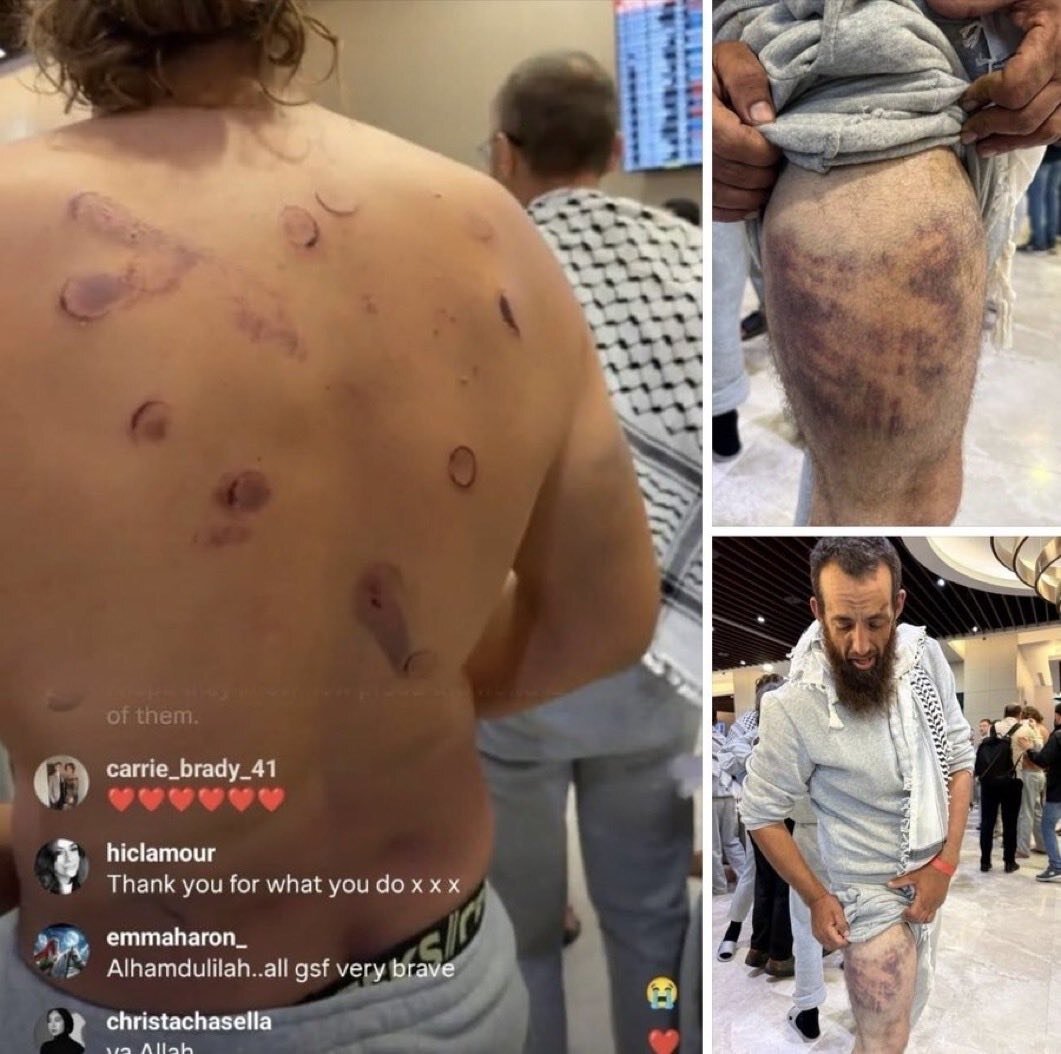 انتشار تصاویر تکاندهنده از وحشیگری علیه ناوگان صمود؛ آنچه میخواستند پنهان بماند فاش شد!