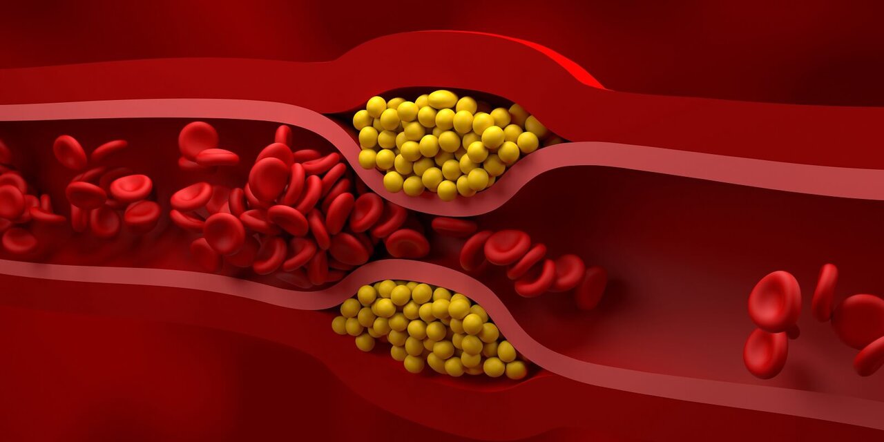 lipid