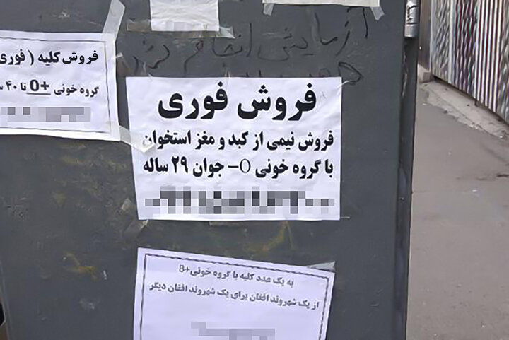 دلالی اعضای بدن در بازار سیاه | انتقال سرطان به دریافت‌کننده غیرقانونی عضو بدن