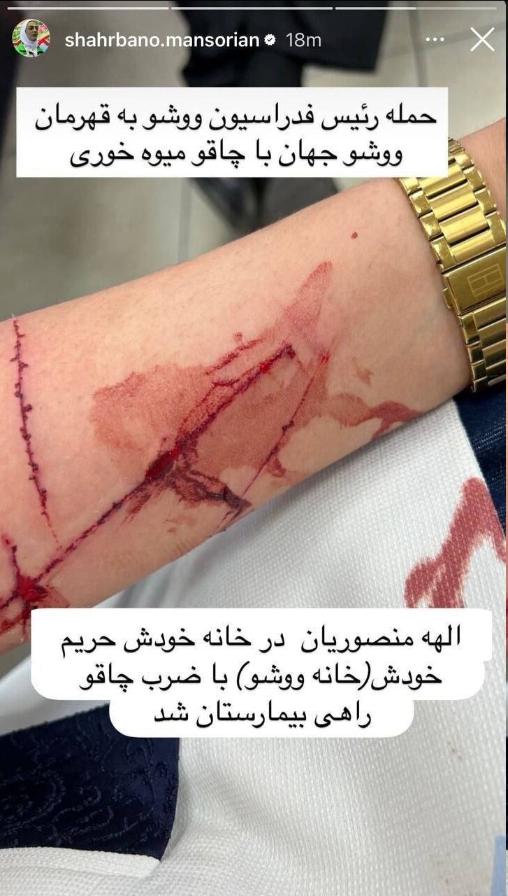 الهه منصوریان در خانه خودش چاقو خورد! | ادعای عجیب پس از جنجال در فدراسیون + عکس