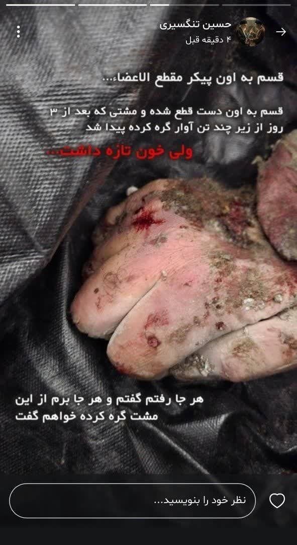 تصویری از مشت گره‌ کرده سردار شهید تنگسیری در لحظه شهادت