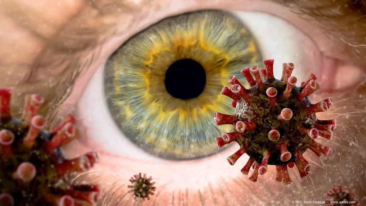 eye