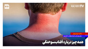 همه‌چیز درباره آفتاب‌سوختگی