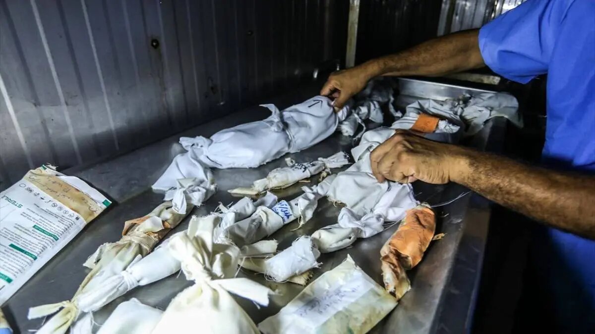 افزایش سقط جنین و مرگ نوزادان در غزه | تصاویر