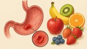 خوردن میوه خام، زمانی که زخم یا نفخ معده دارید، کار درستی است؟