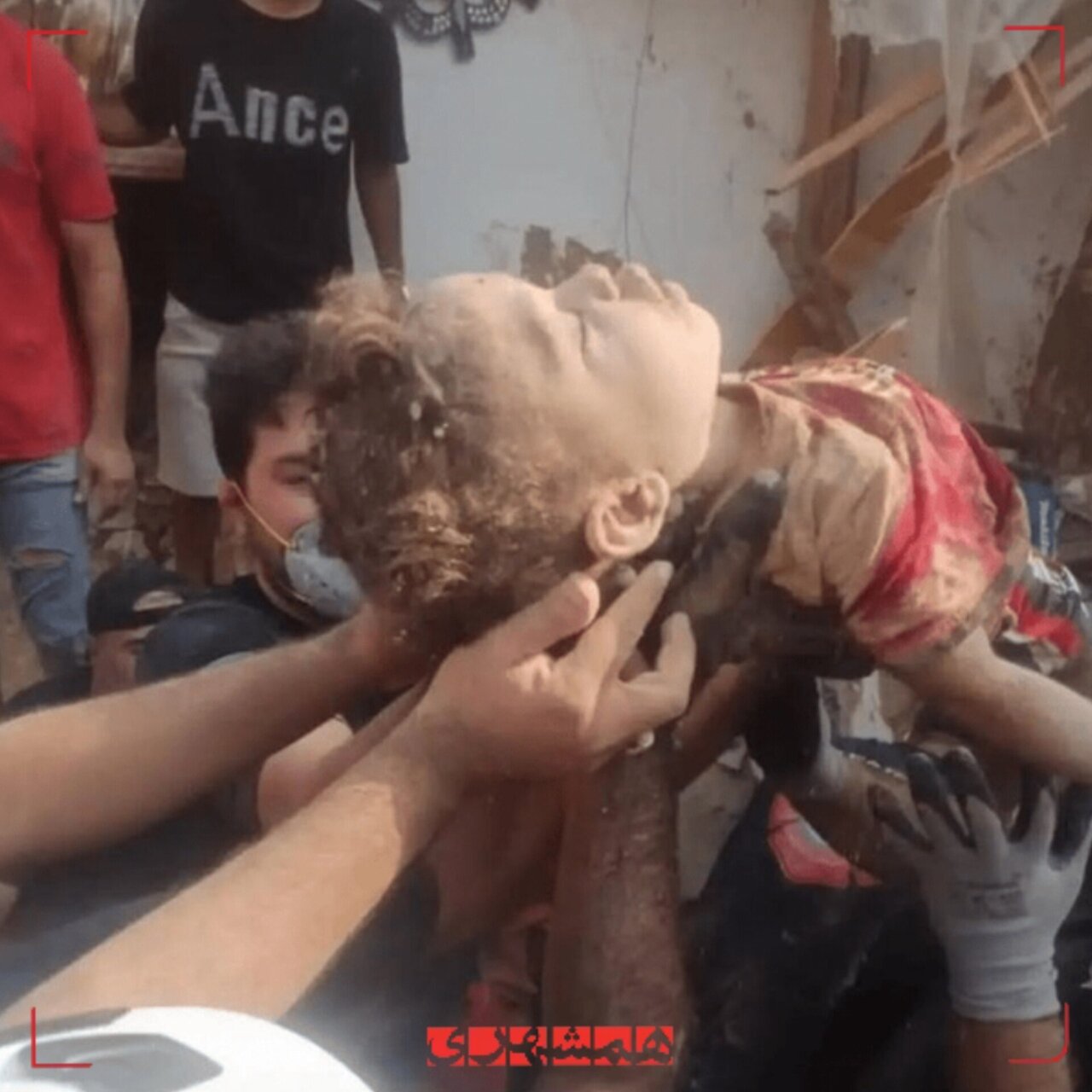 Image of the body of a 2-year-old child from the US attack on Qeshm