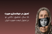 توسعه یک تکنیک نوین لیفت صورت در ایران پس از 15 سال تحقیق و بررسی تخصصی