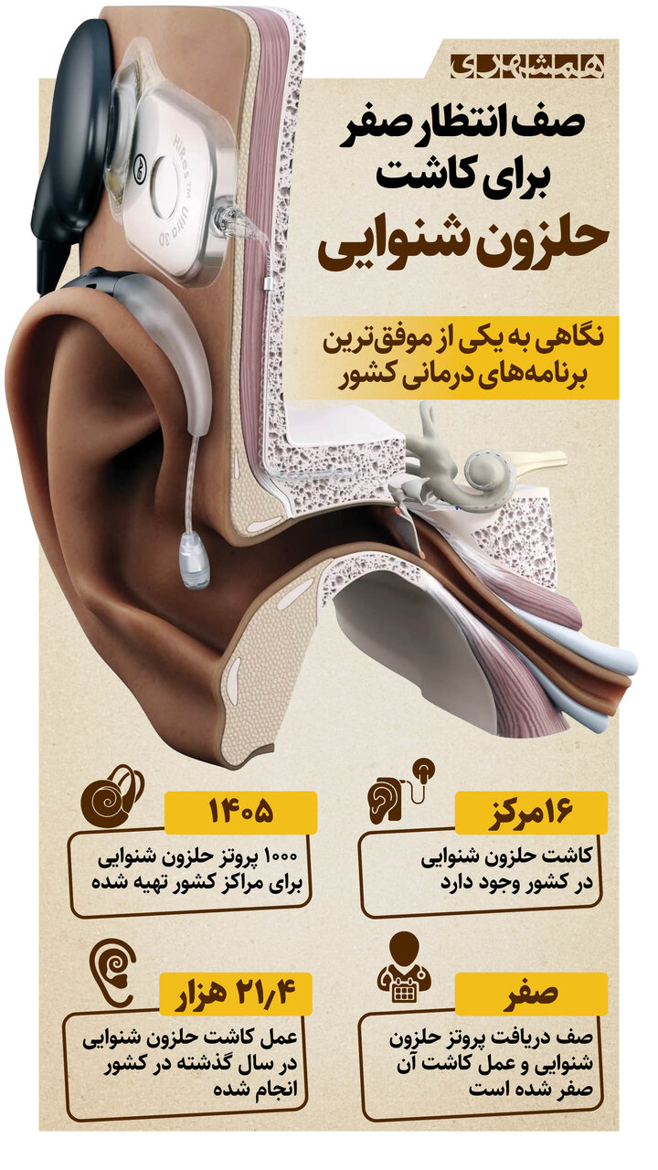 صدای یک زندگی | صف انتظار صفر برای کاشت حلزون شنوایی| اینفوگرافیک