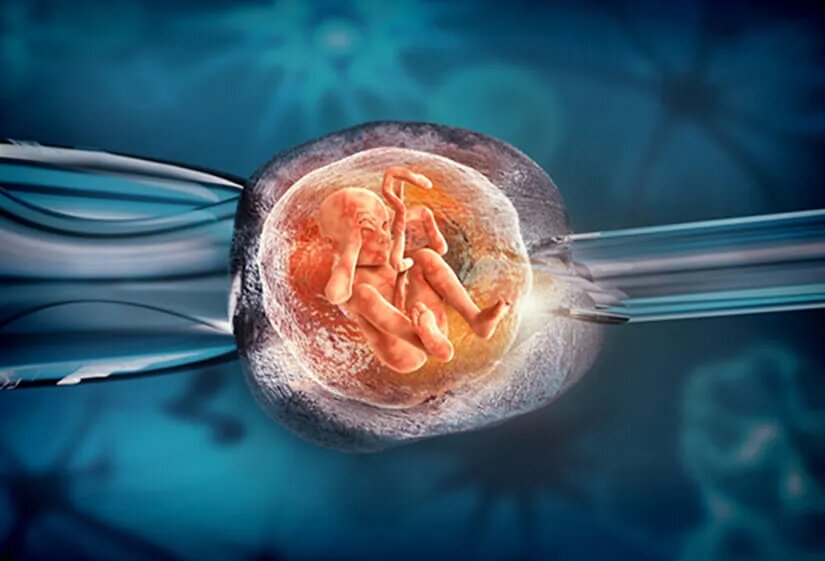 IVF