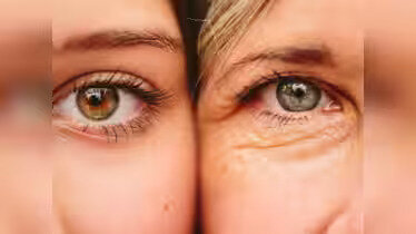 aging