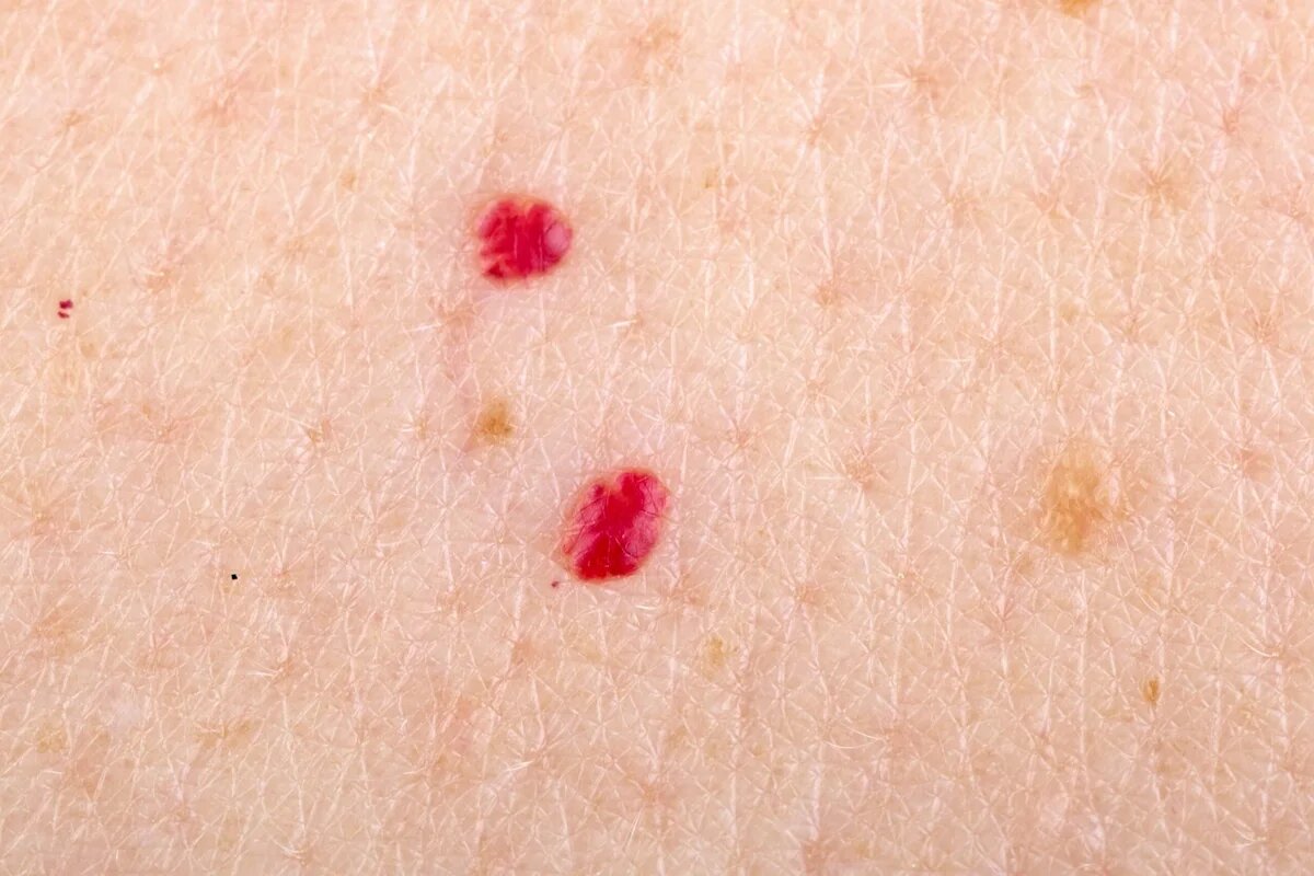 red dots