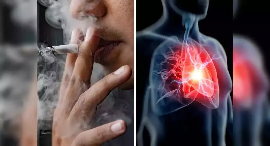 smoking