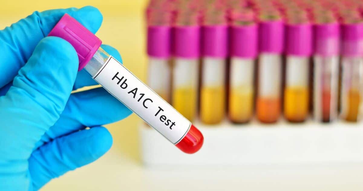 HbA1c