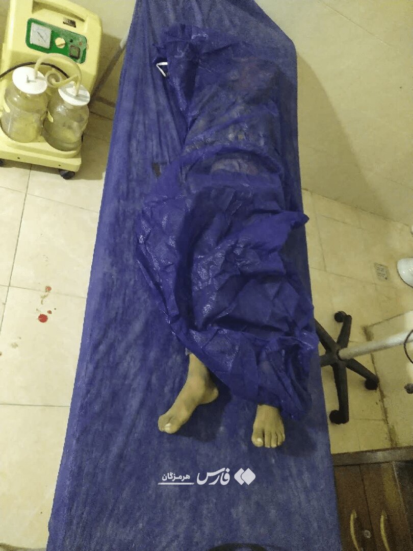 تصویر امیرعلی کریمی، کودکی که در عروسی سیریک به شهادت رسید