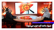 میوه باعث کبد چرب می‌شود؟