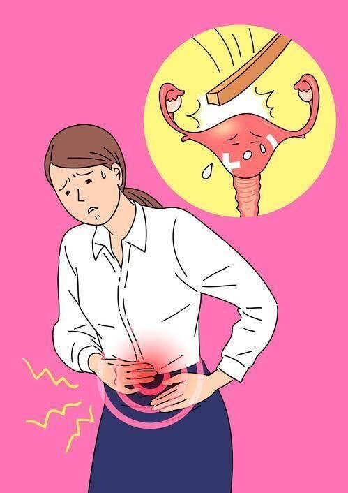 فیبروم رحم از صفر تا صد؛ فیبروم دقیقاً چیست؟ | برای درمان فیبروم رحم چه باید کرد؟ | آیا داشتن فیبروم به معنی ناباروری است؟