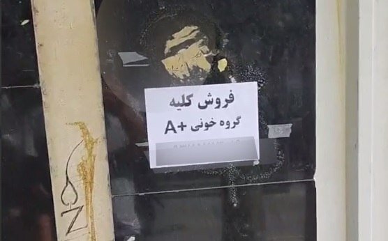 فروش کلیه