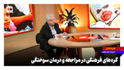 گره‌های فرهنگی در مراجعه و درمان سوختگی