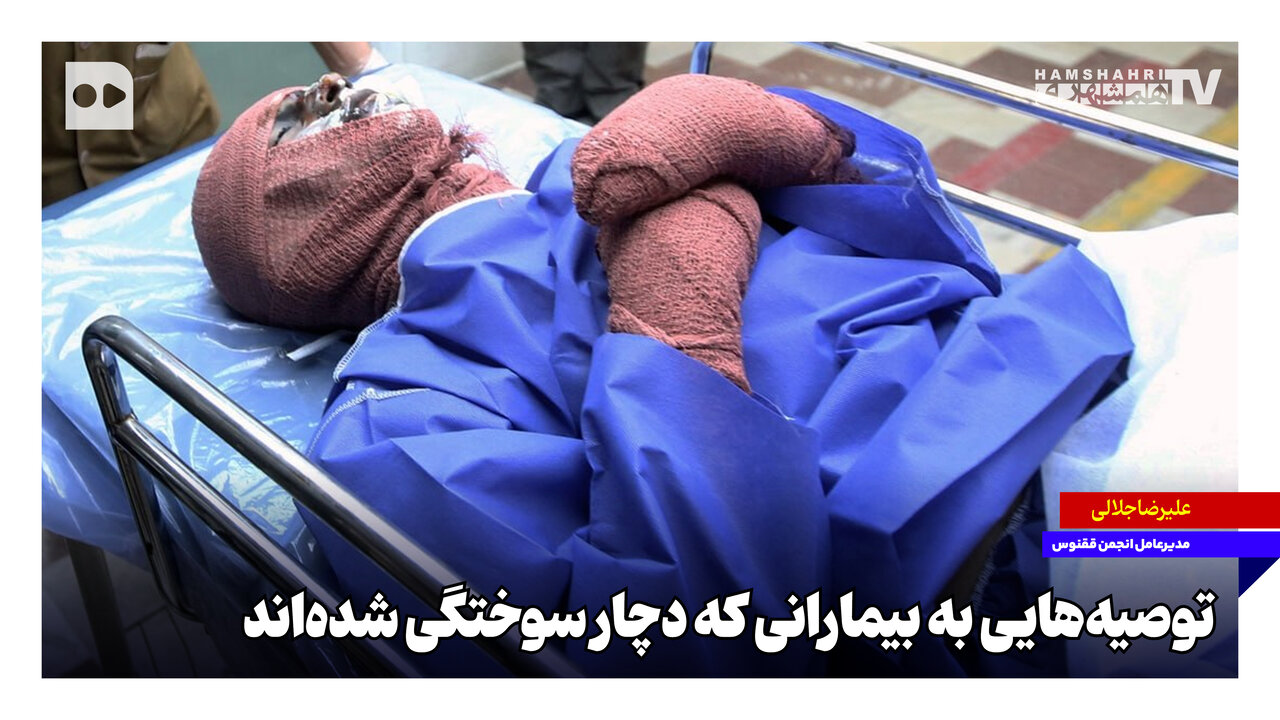 مدیرعامل انجمن ققنوس: توصیه‌های ویژه برای بیماران سوختگی کودکی و راه‌های بازگشت به زندگی معنادار