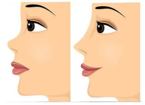 بهترین جراح بینی در شیراز