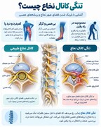 علائم تومور مغزی چیست؟ نشانه‌هایی که نباید نادیده گرفته شوند