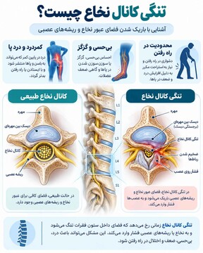 علائم تومور مغزی چیست؟ نشانه‌هایی که نباید نادیده گرفته شوند