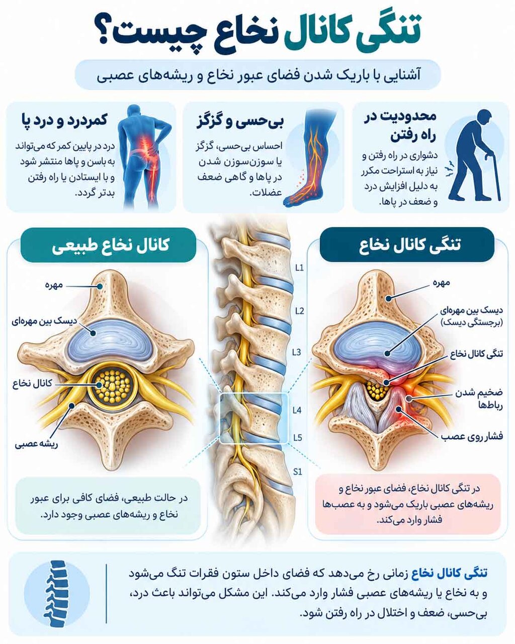 تومور مغزی چیست