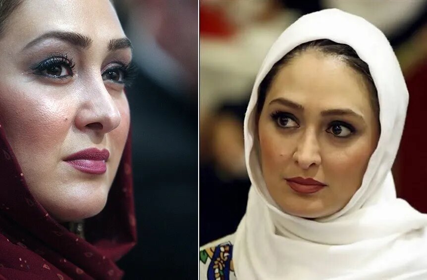 تغییر عجیب چهره الهام حمیدی سوژه شد + عکس
