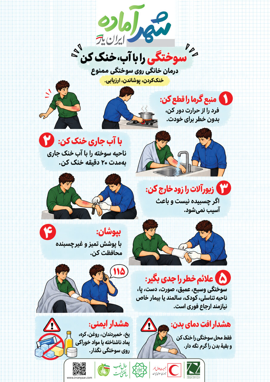 اولین کاری که بعد از سوختگی باید انجام دهید | چرا خمیردندان و روغن و یخ برای پوست سوخته خطرناکاند؟
